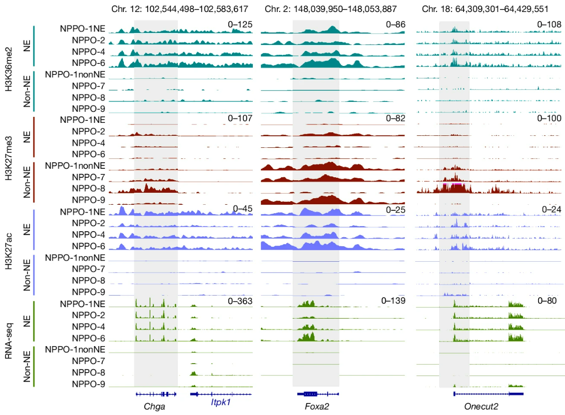 Multiple IGV tracks of histone modifications across neuroendocrine and non-neuroendocrine tumors