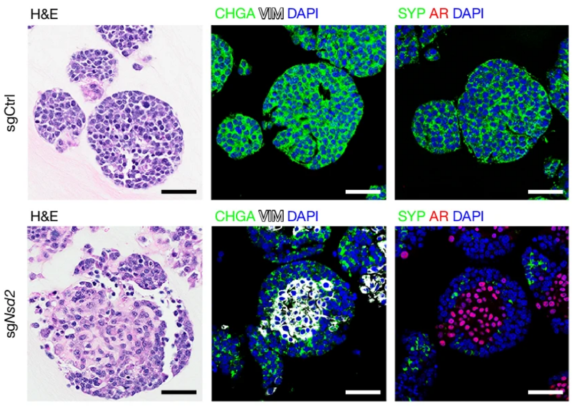 Staining images of prostate organoids